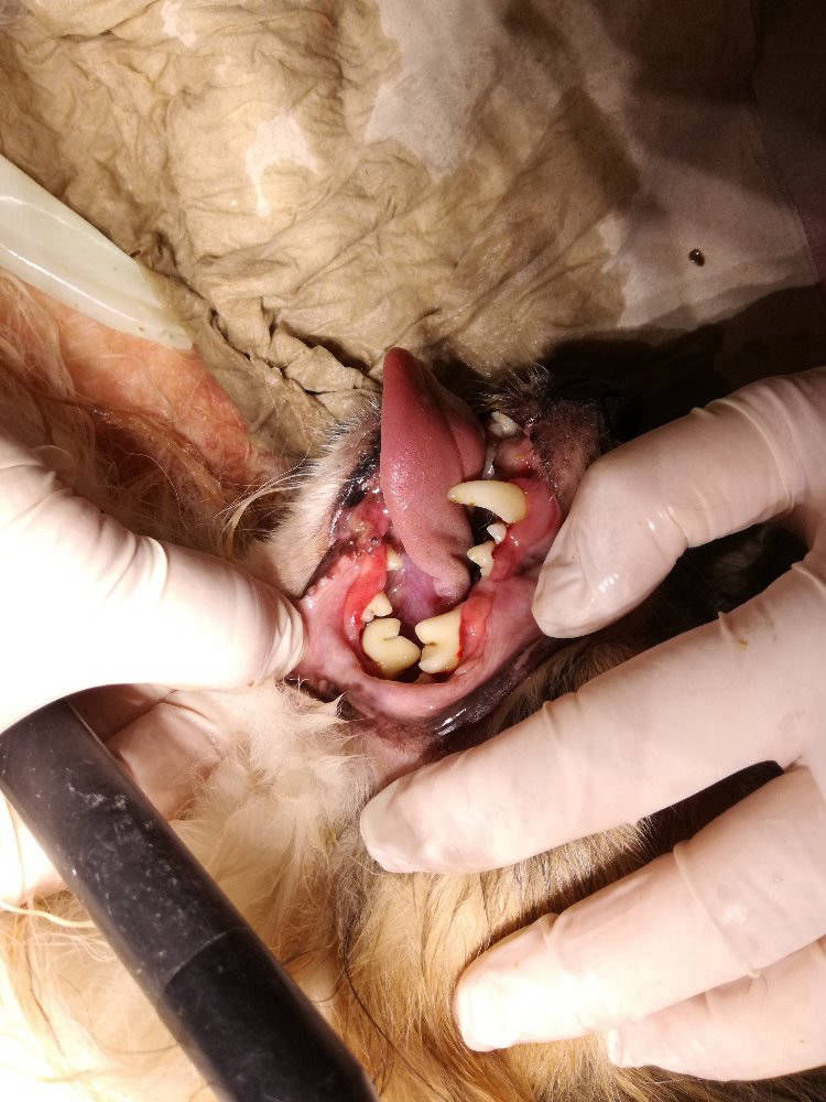 zubní kámen - po odstranění